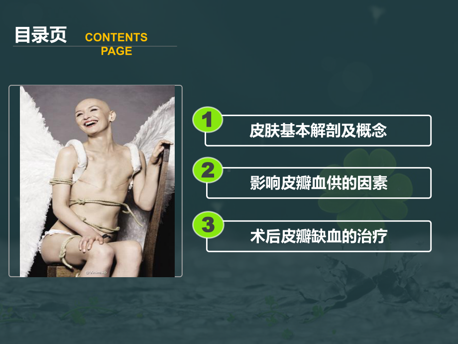 may乳腺癌手术皮瓣相关处理课件.pptx_第2页