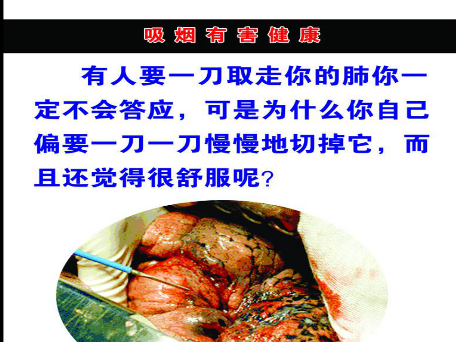 《吸烟有害健康》主题班会课件[1].ppt_第3页