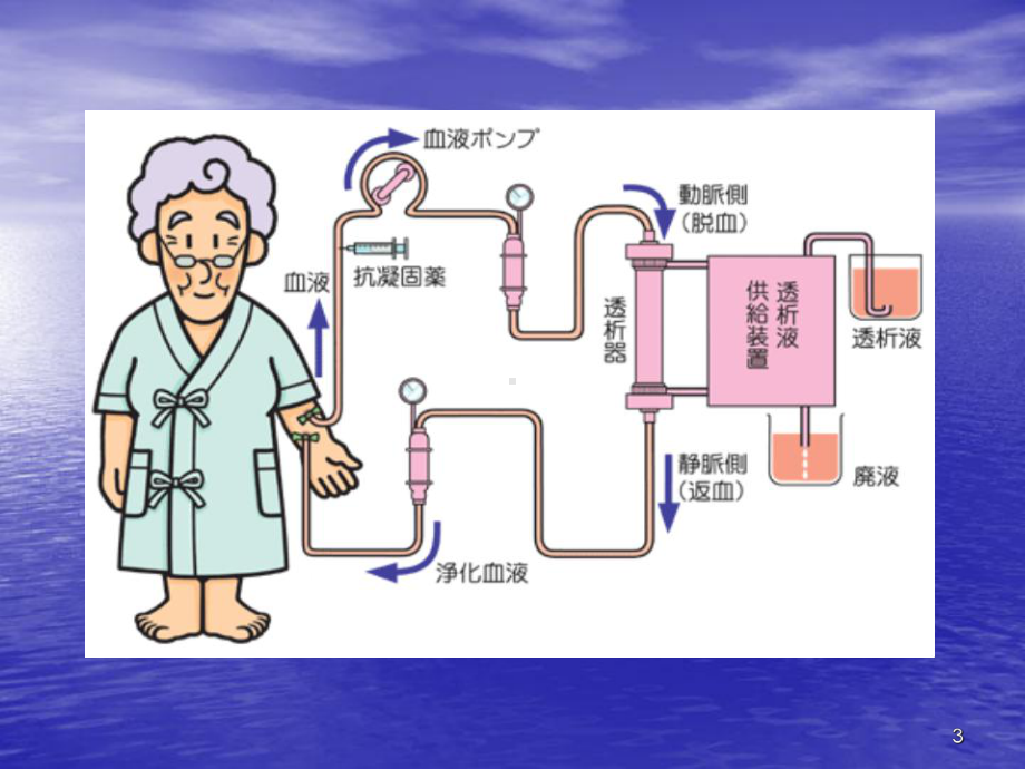 不同血液净化方式的临床应用教学课件.ppt_第3页