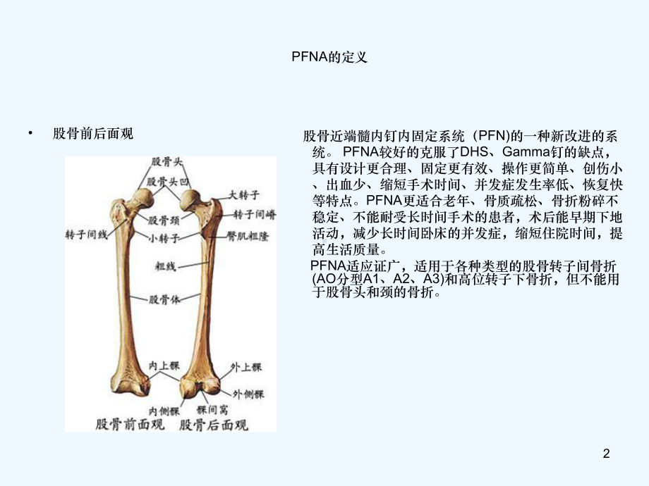 PFNA内固定术的护理查房(同名738)课件.ppt_第2页