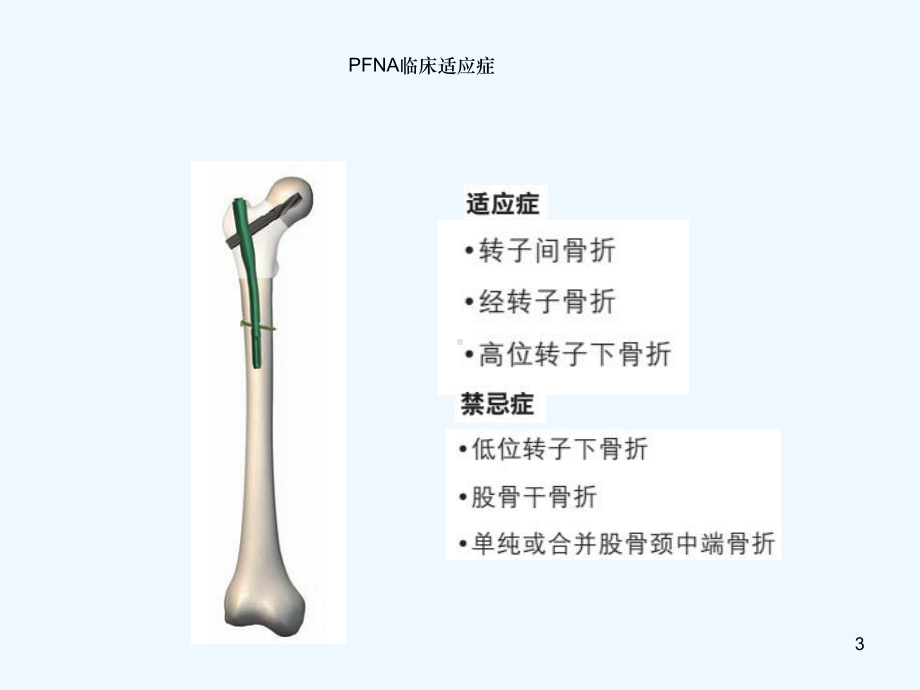 PFNA内固定术的护理查房(同名738)课件.ppt_第3页