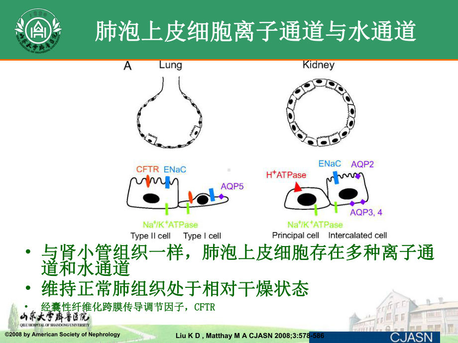 ARDS患者液体管理策略课件.ppt_第3页