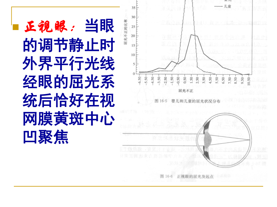 5、屈光不正和老视病人的护理课件.ppt_第3页