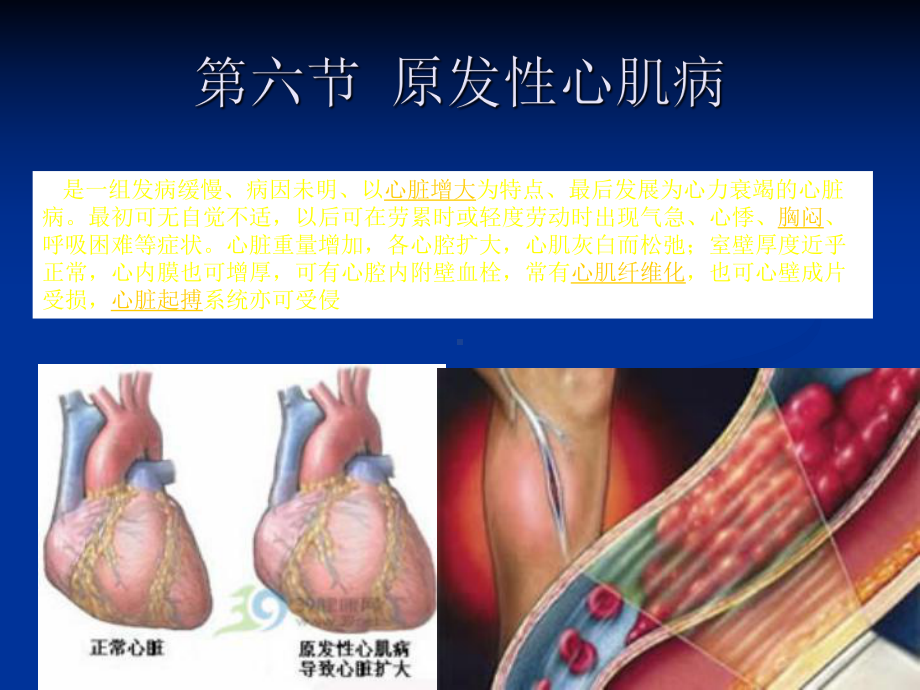 S心肌病教学讲解课件.ppt_第1页