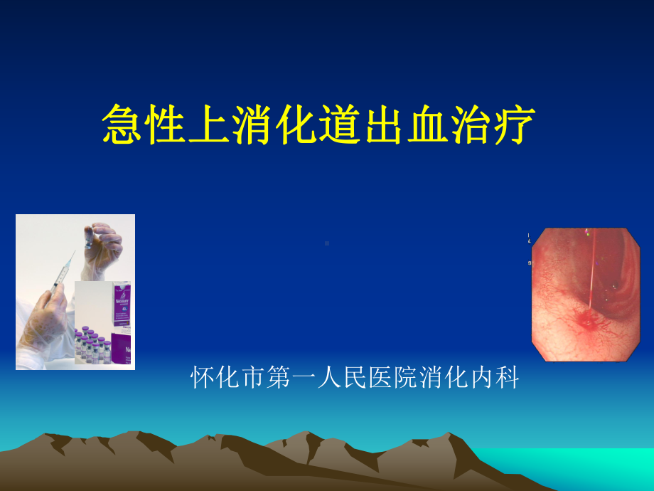 上消化道出血的诊断及治疗研究进展课件.ppt_第1页