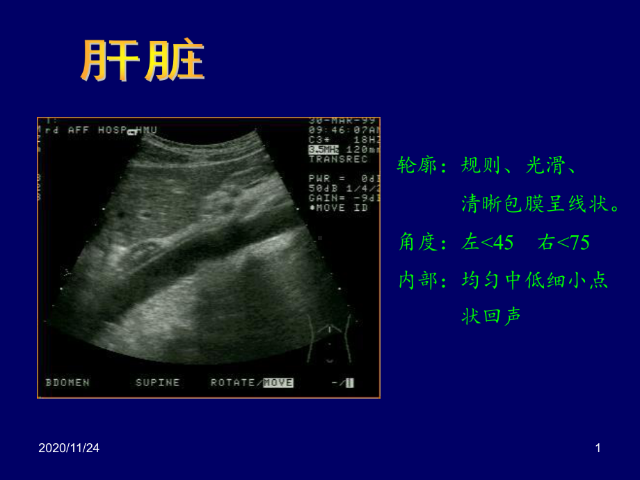 B超影像图谱-课件.ppt_第1页