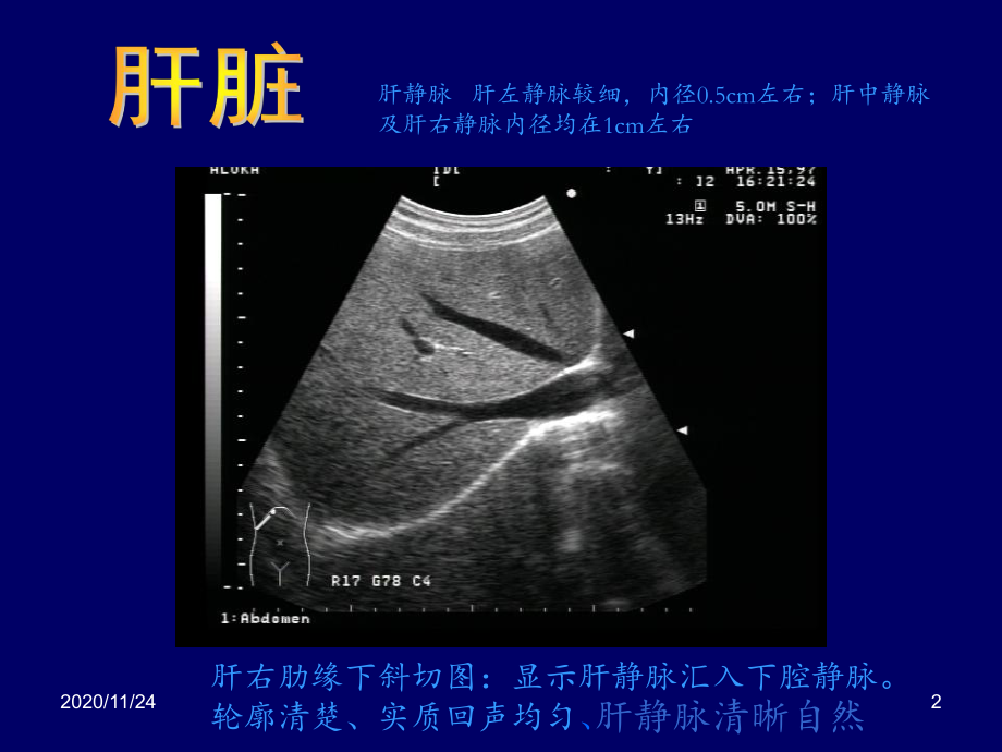 B超影像图谱-课件.ppt_第2页