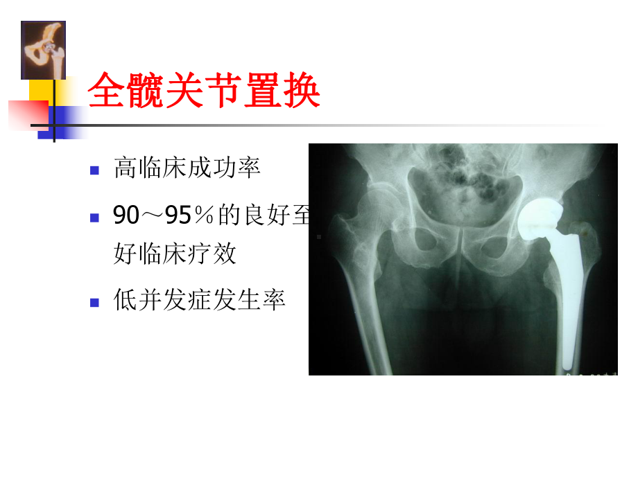 THA围手术期处理课件.ppt_第2页