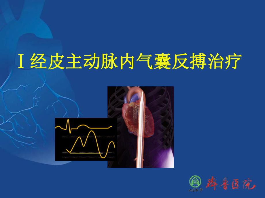 pci高危辅助策略课件.ppt_第3页