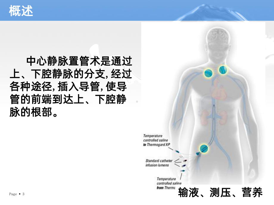 中心静脉置管术的护理课件讲义.ppt_第3页