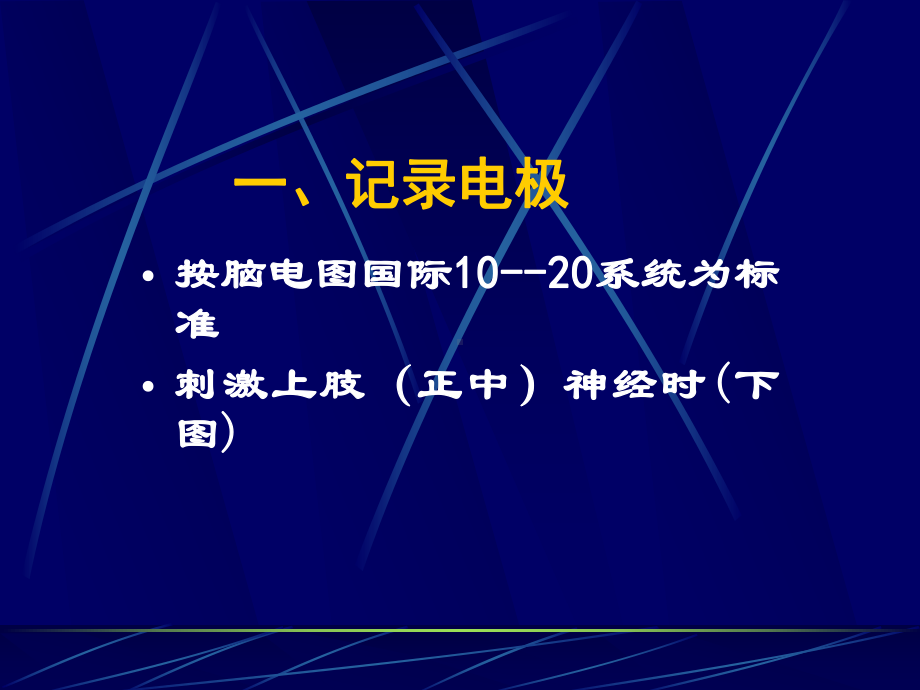 [宝典]躯体体诱发电位(SEP)对重症疾病的监护课件.ppt_第2页