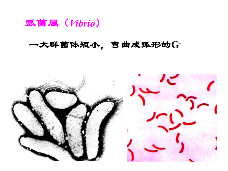 [医学微生物学]弧菌属螺杆菌属厌氧性细菌课件.ppt_第3页