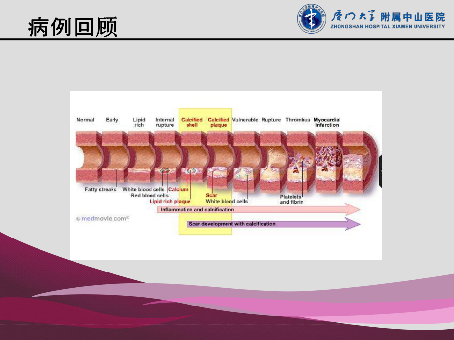 中心静脉置管与血栓形成课件.ppt_第3页