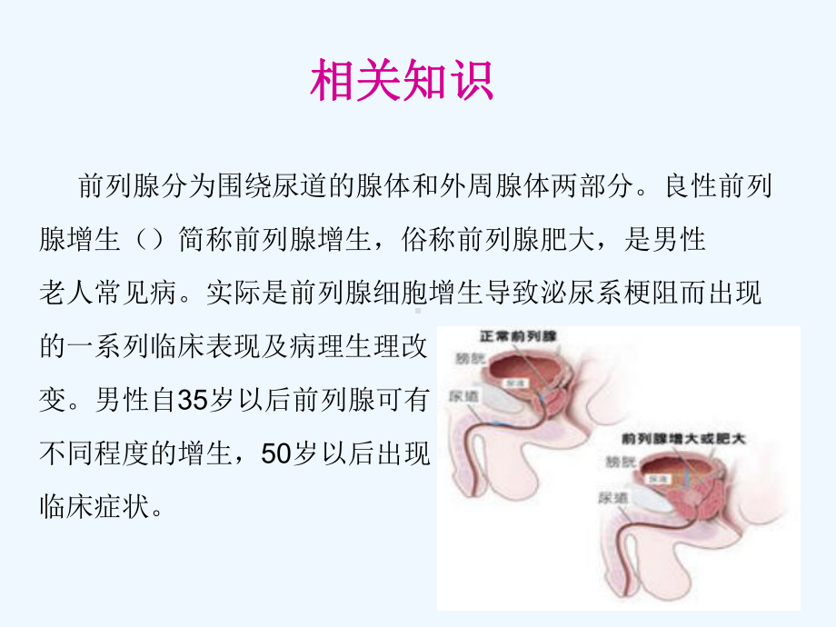 MicrosoftPowerPoint前列腺增生术后护理课件.ppt_第2页