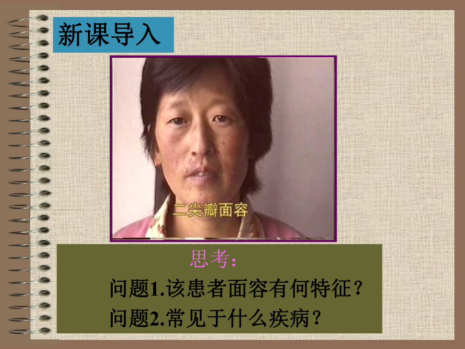 6第六节心脏瓣膜病病人的护理课件.ppt_第2页