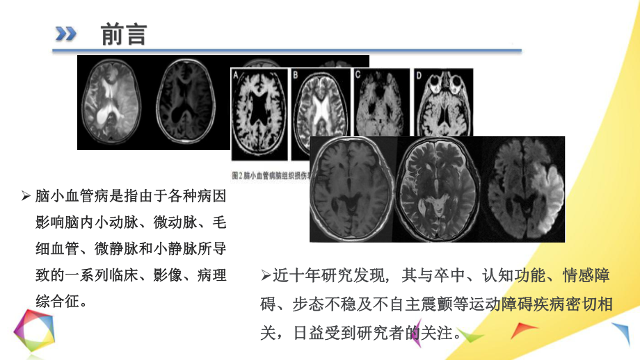 《脑小血管病》课件.pptx_第2页