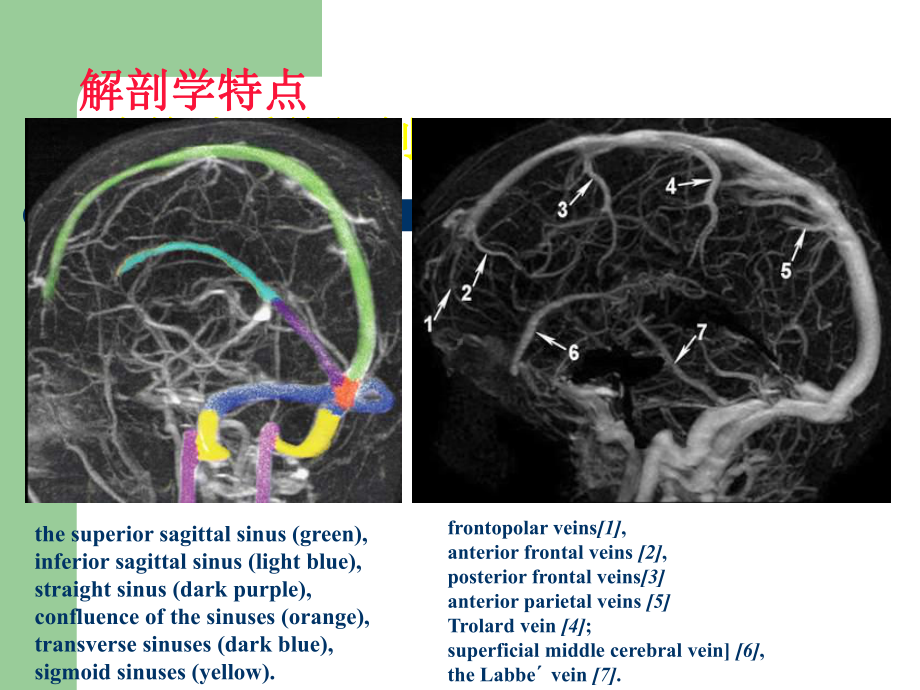 AHA静脉血栓形成20130519课件.ppt_第3页