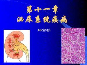 中山医科大学病理学课件第十一章 泌尿系统疾病2.ppt