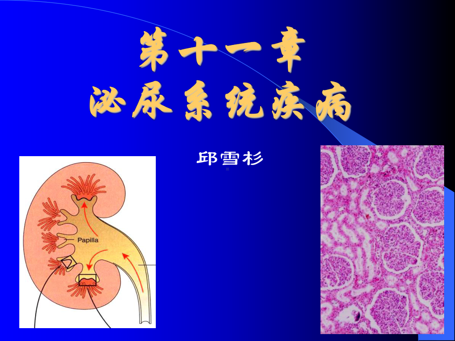 中山医科大学病理学课件第十一章 泌尿系统疾病2.ppt_第1页