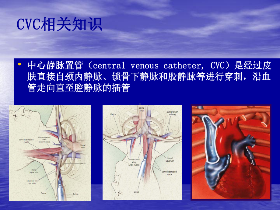 2013院内静疗专科护士培训班第一期第一课课件.ppt_第2页