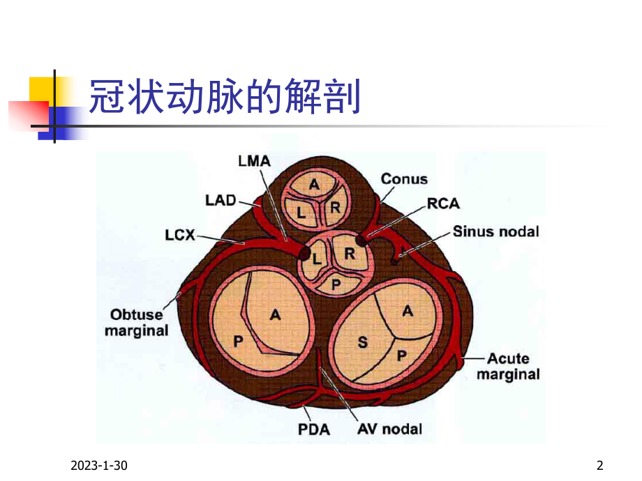 AMI的心电图应用课件.ppt_第2页