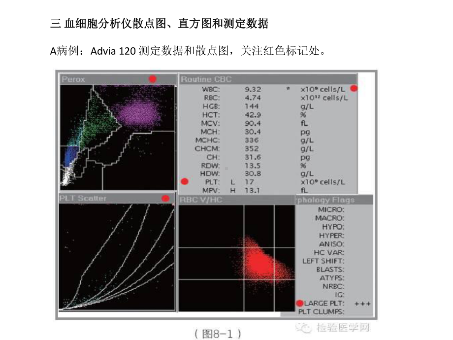 EDTA依赖性假性血小板减少课件.pptx_第3页