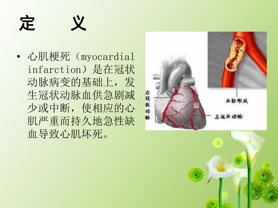 心肌梗死康复护理确定版课件.ppt_第3页