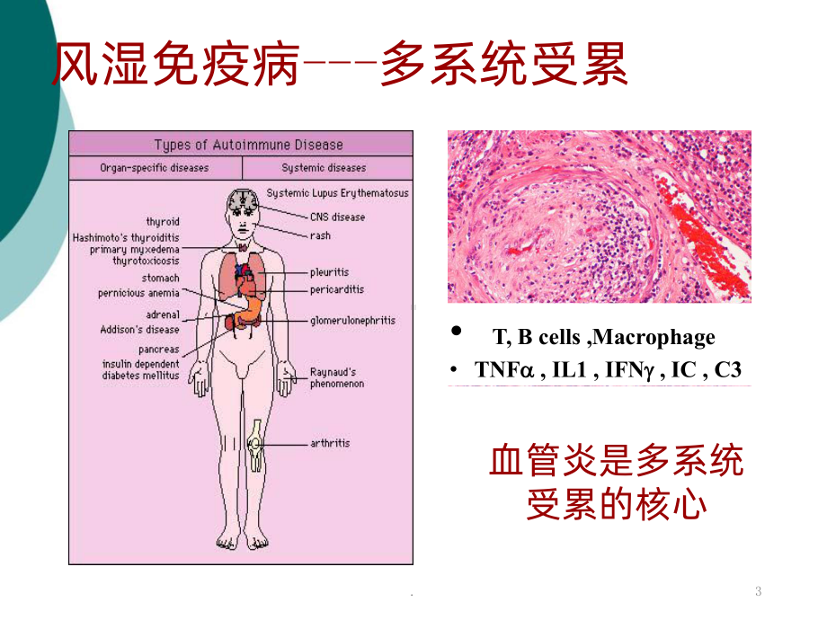 自身免疫性疾病的消化系统损害课件.ppt_第3页