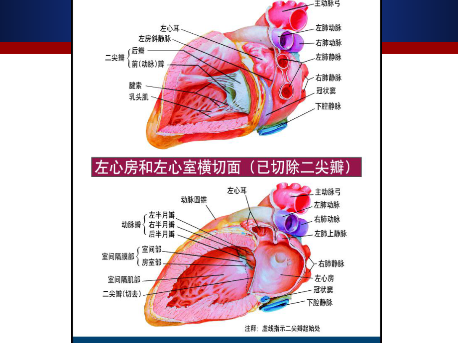 心肌病护理课件.ppt_第3页