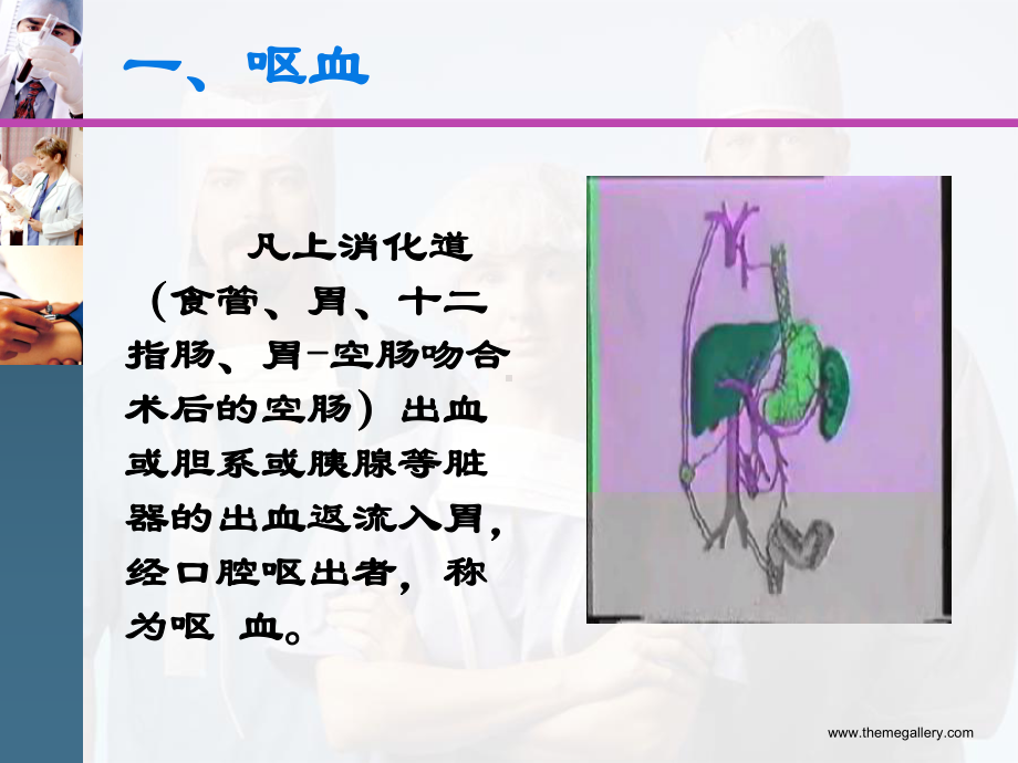 西医诊断学11呕血与便血课件整理.ppt_第2页