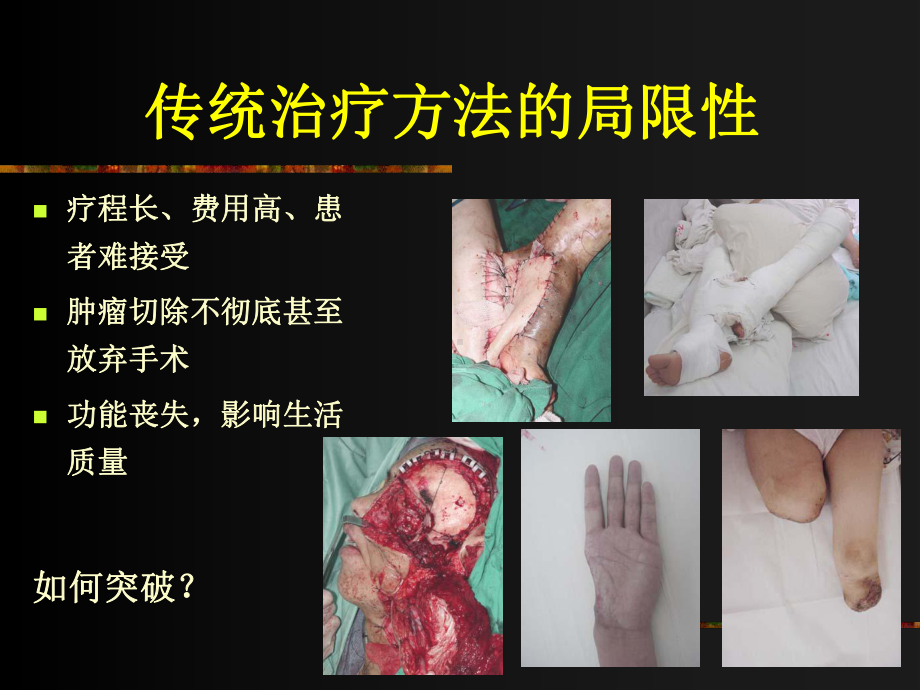 显微外科概论课件.ppt_第3页