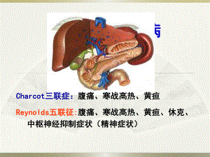第8节胆道疾病课件.pptx