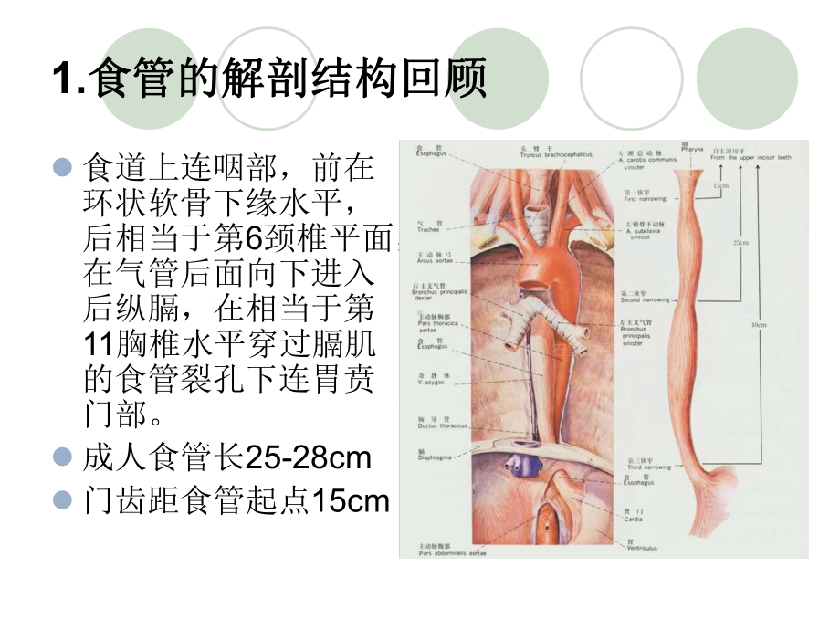 第四章第二节食管癌病人的护理课件.ppt_第3页