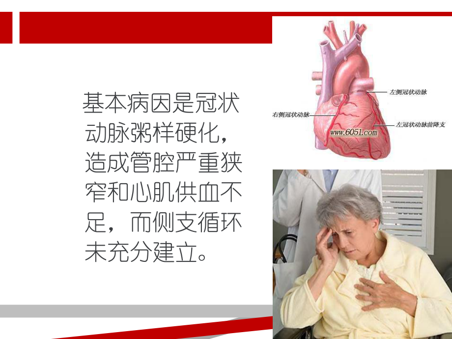 急性心肌梗死的护理措施78472课件.ppt_第3页