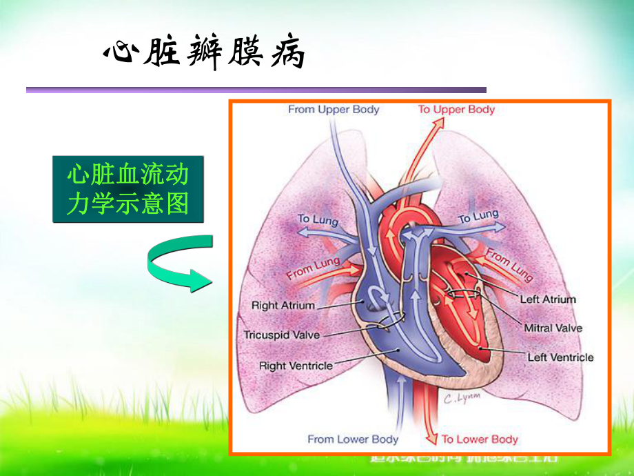 心脏瓣膜病病人的护理1 课件.ppt_第3页