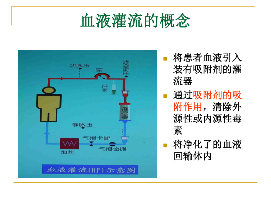 血液灌流的临床应用1030课件.ppt_第2页