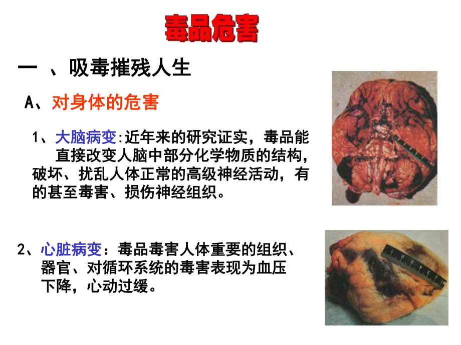 珍爱生命远离毒品课件讲义.ppt_第2页