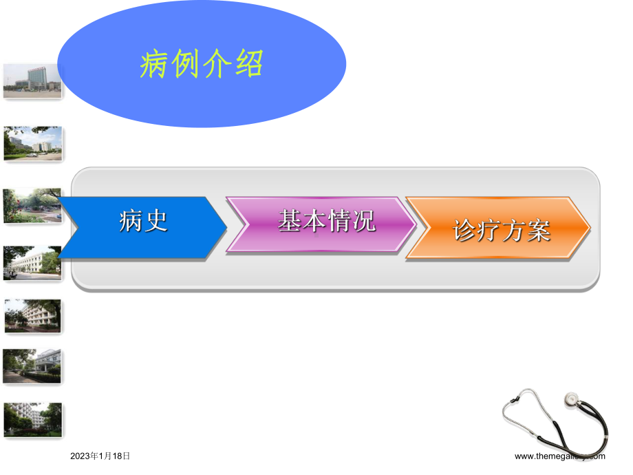 刘利艳胃癌术后炎性肠梗阻病例讨论课件.ppt_第3页