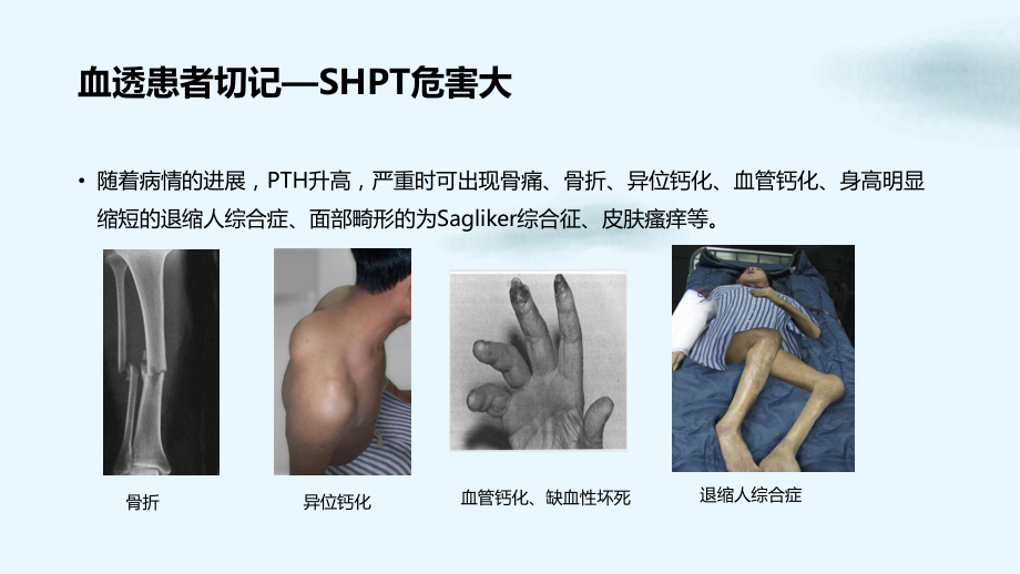 继发性甲旁亢日常治疗管理及生活护理优质课件.ppt_第3页