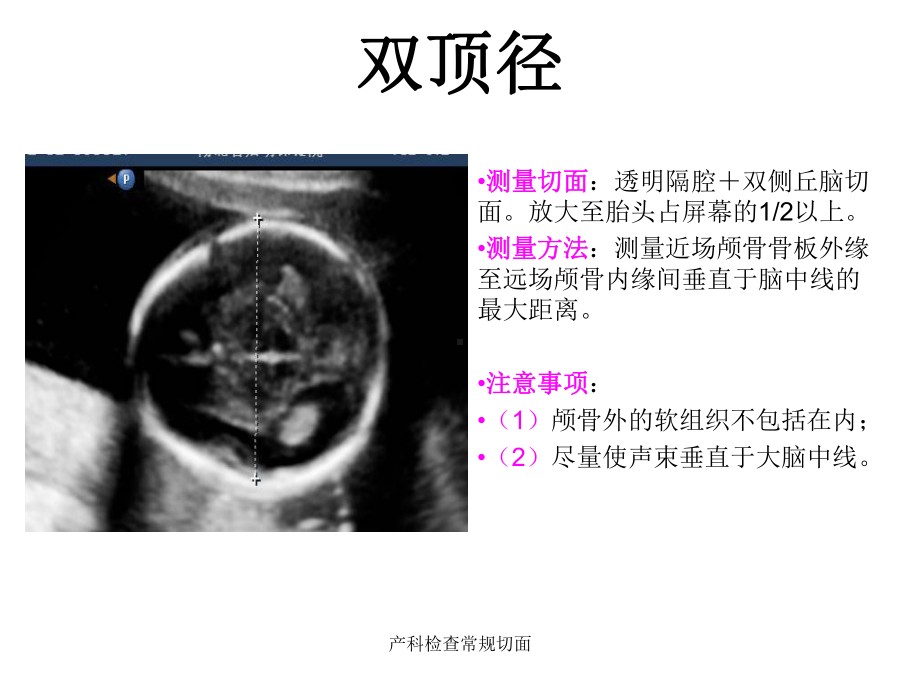 产科检查常规切面课件.ppt_第3页