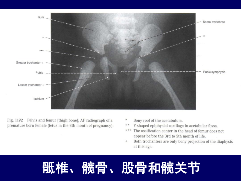 人体断层解剖学下肢断层解剖课件.ppt_第3页