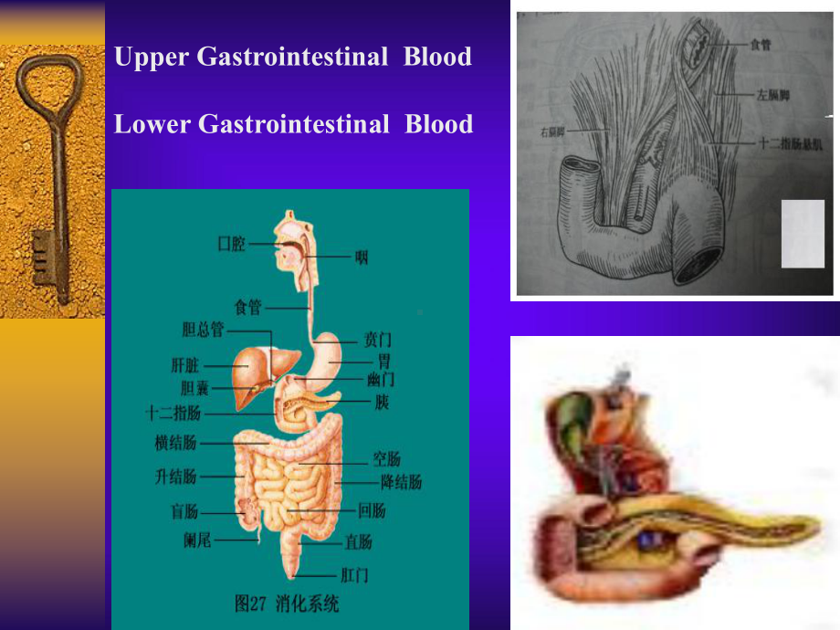 呕血便血2013课件.ppt_第2页