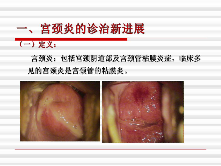 宫颈疾病诊治中值得重视的几个问题(新)课件.ppt_第3页