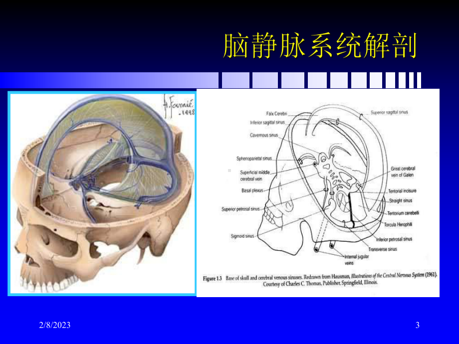 脑静脉和静脉窦血栓形成新进展资料课件.ppt_第3页