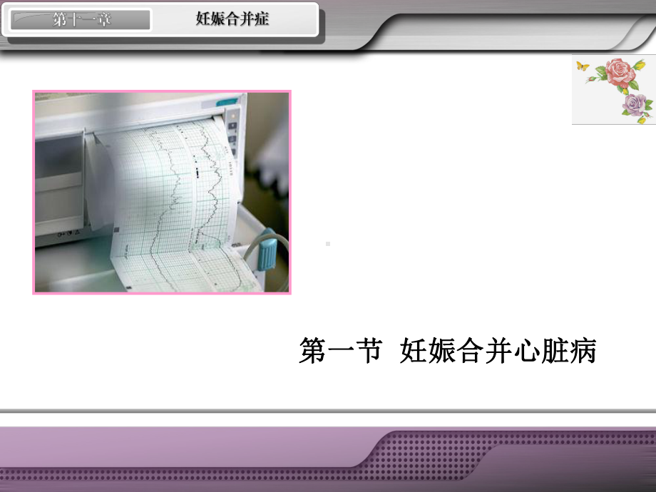 妊娠合并心脏病2012722课件.ppt_第2页