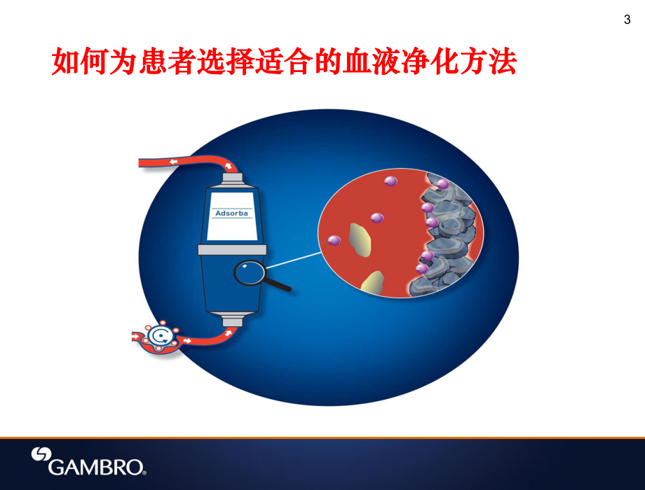 血液灌流HP课件.ppt_第3页