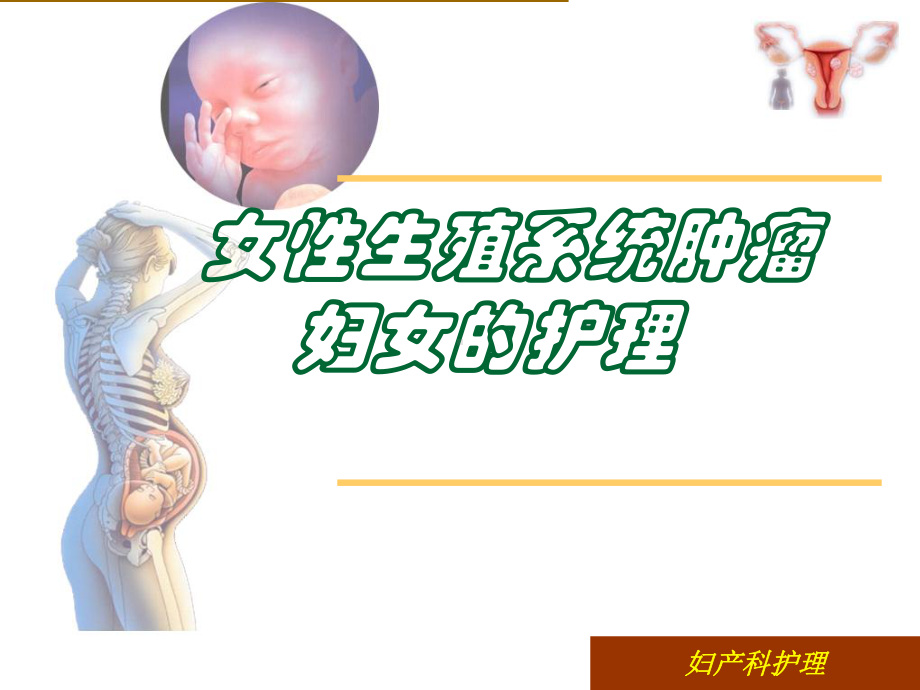 医学类女性生殖系统肿瘤妇女的护理课件.ppt_第2页