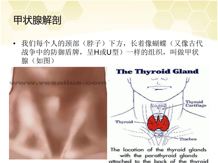 甲状腺手术课件1.ppt_第3页