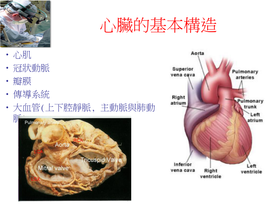 加护病房心脏外科训练课程课件.ppt_第2页