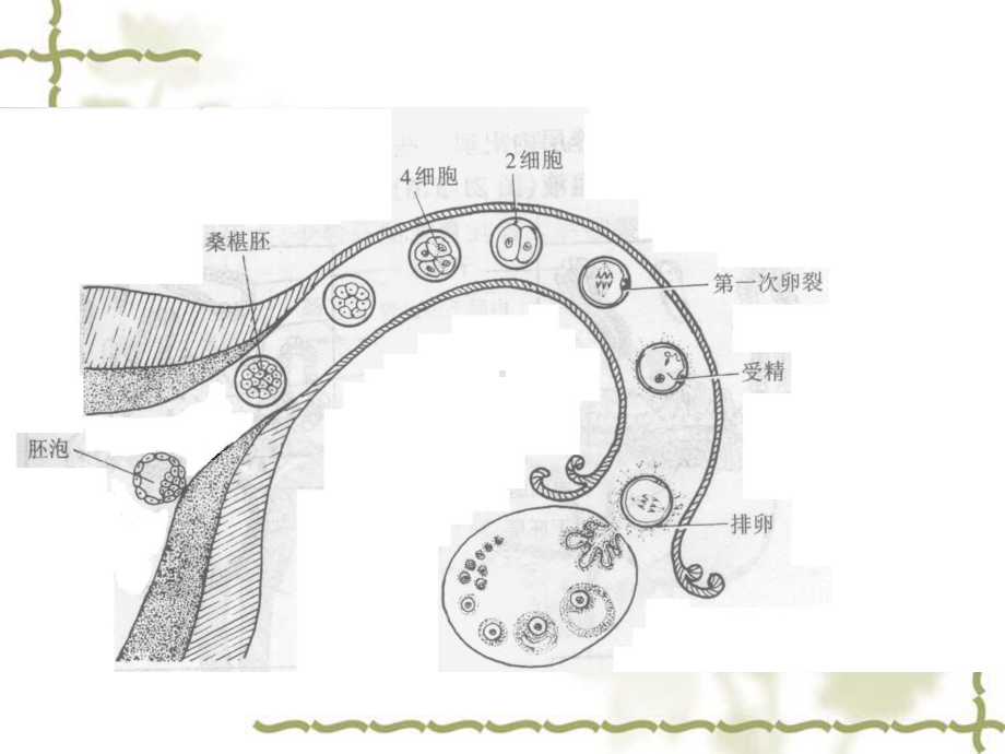 第十五章妊娠滋养细胞疾病人的护理课件讲义讲义.ppt_第3页